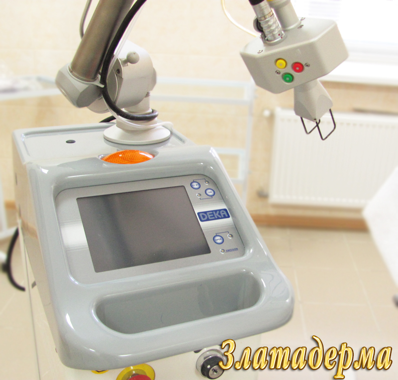 лазерная шлифовка