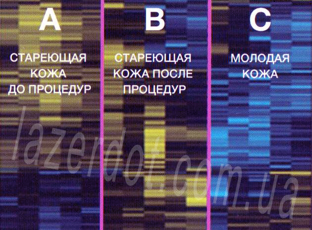 лечение сосудистых патологий