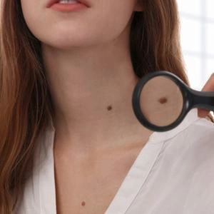 Видалення новоутворень