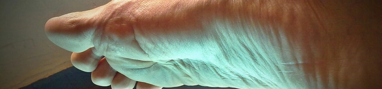 Лазерное удаление мозолей в Николаеве