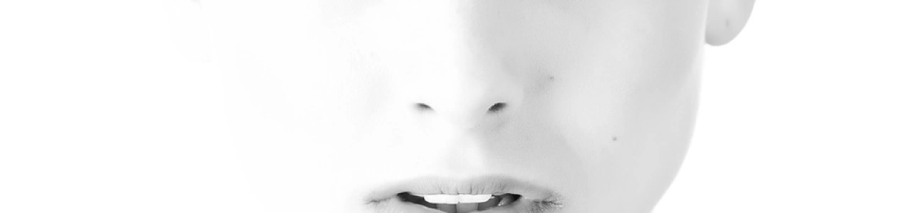 Какие нити лучше для подтяжки