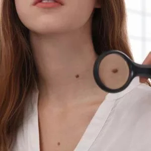 Удаление новообразований