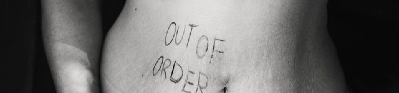 Лазерный липолиз – будь стройной!