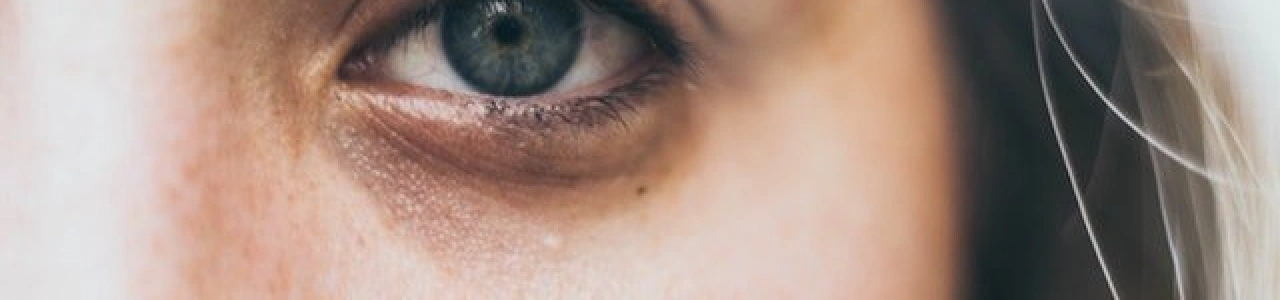 Суфи на обличчі: як позбутися