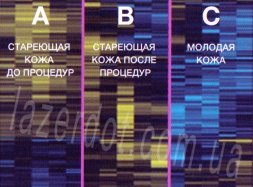 лікування судинних патологій
