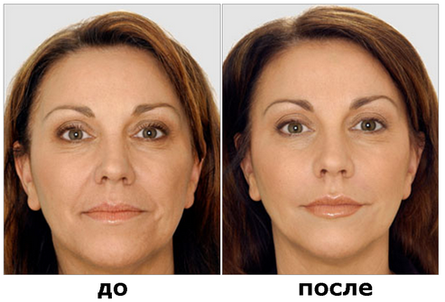 1405512634_ььрпорпаbotoks_01