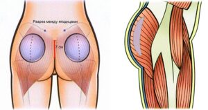увеличить попу