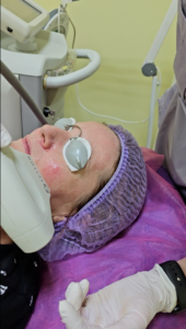 лікування куперозу